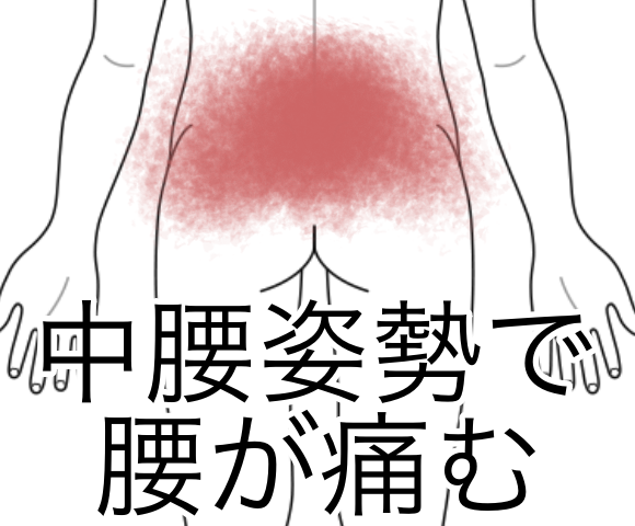 なぜ腰痛は繰り返す？解剖学から見る「腸腰筋（ちょうようきん）」の重要性