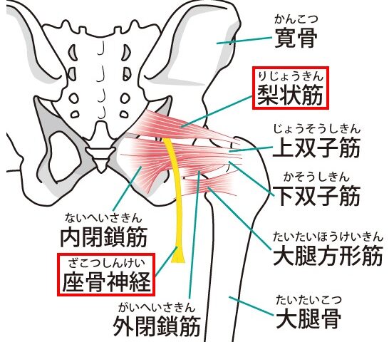 坐骨神経痛について