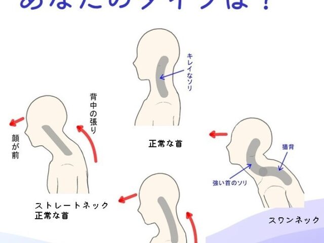 最初は軽い違和感でも、放っておくと慢性的な症状につながる場合があります