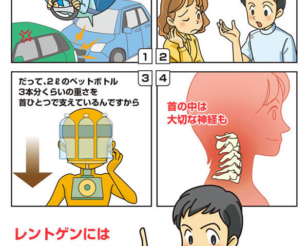 事故直後は興奮状態や緊張によって痛みを感じにくいこともあります