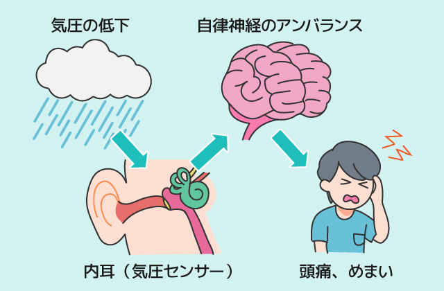 「雨が降る前になると頭痛がする」