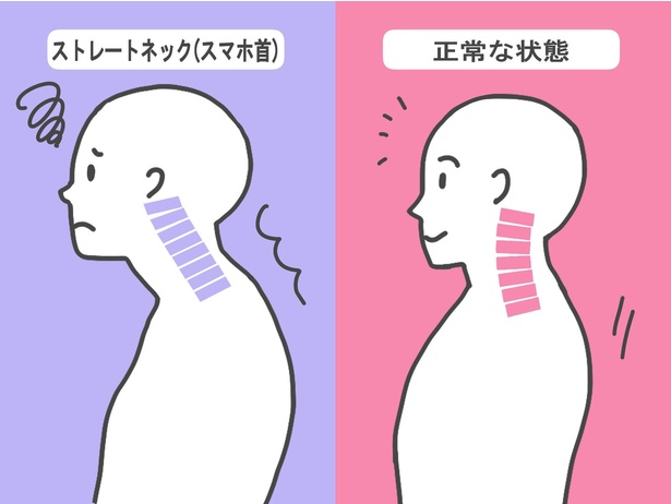 与野で姿勢改善・頭痛・首の辛さにお悩みの方へ｜きざき整骨院