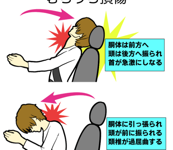 出先での交通事故対応致します